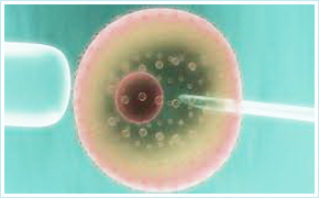 Intracytoplasmic Sperm Injection Icsi Bfc Bahosi Fertility Centre